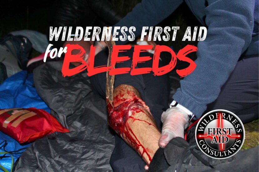 Wilderness First Aid for Bleeding